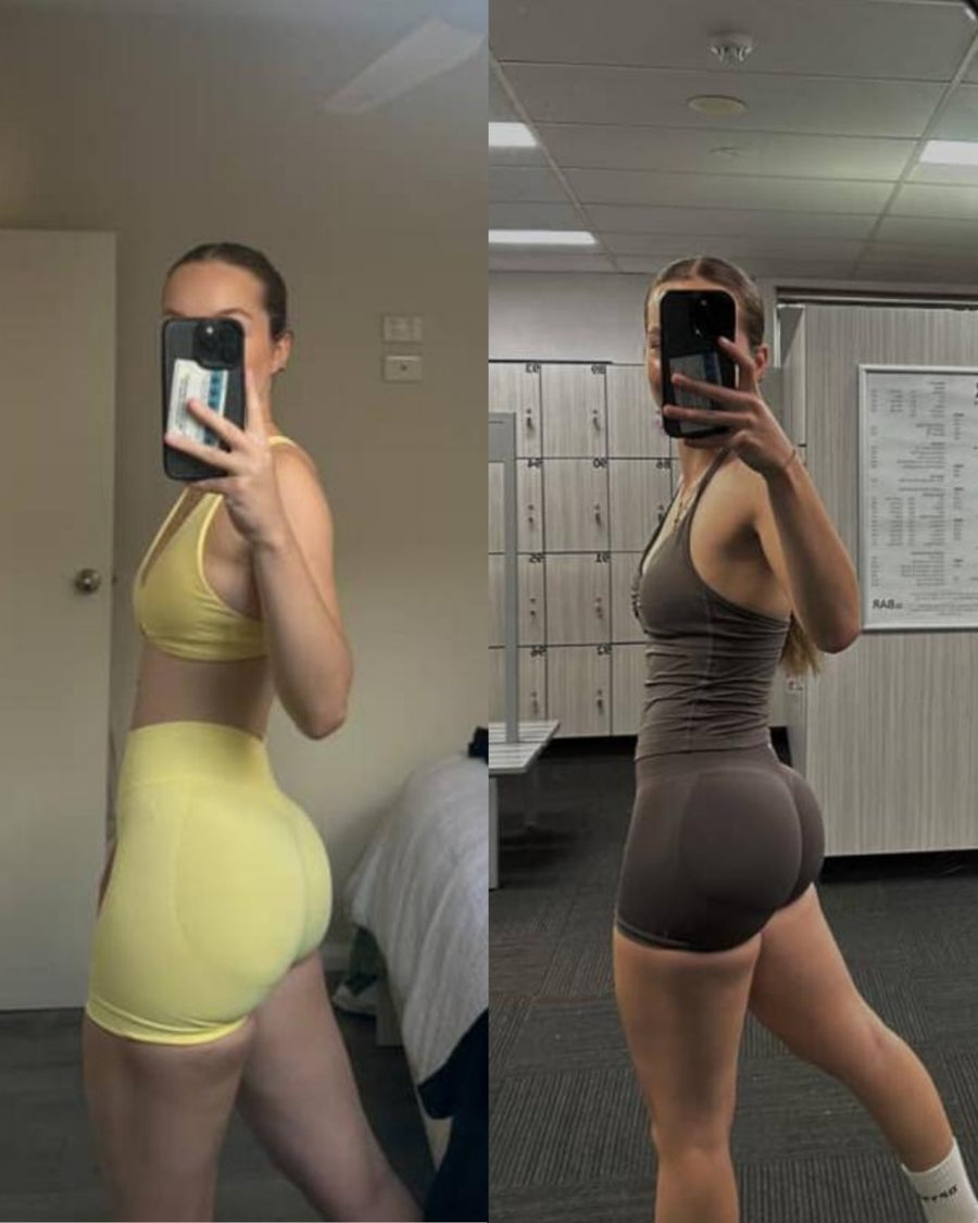 RareBody member before and after