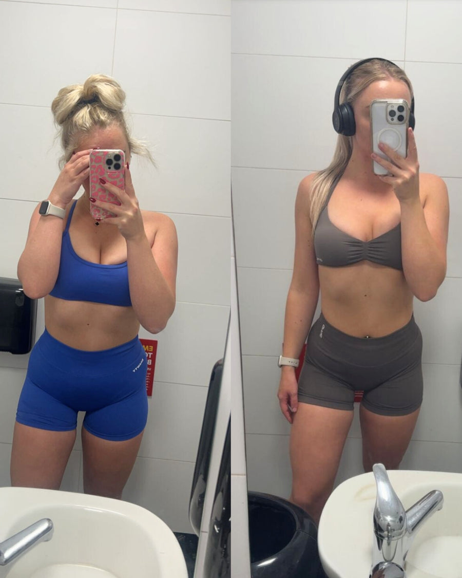 RareBody member before and after