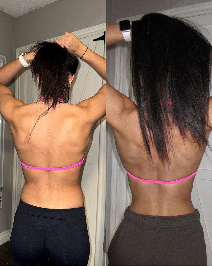 RareBody member before and after
