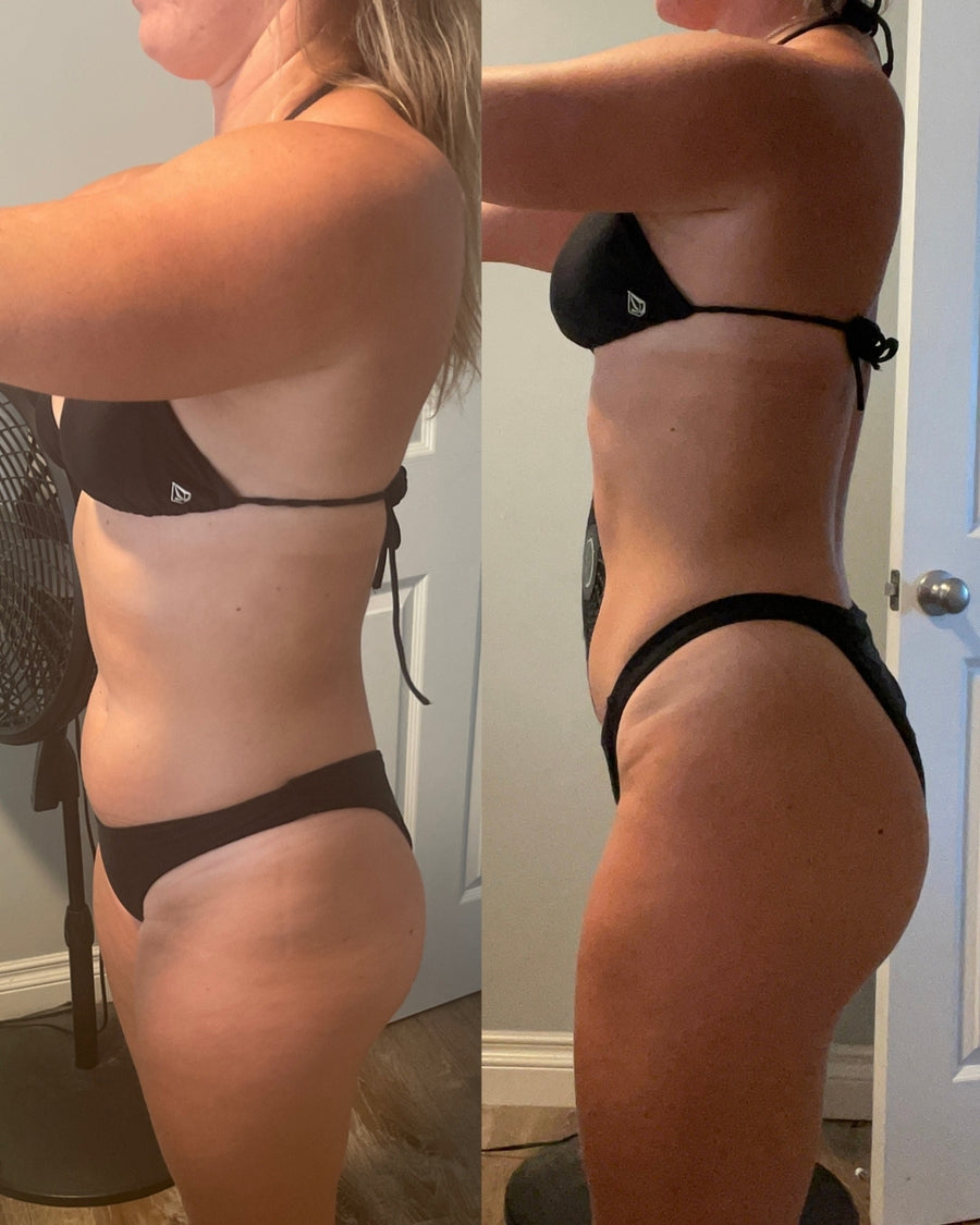 RareBody member before and after