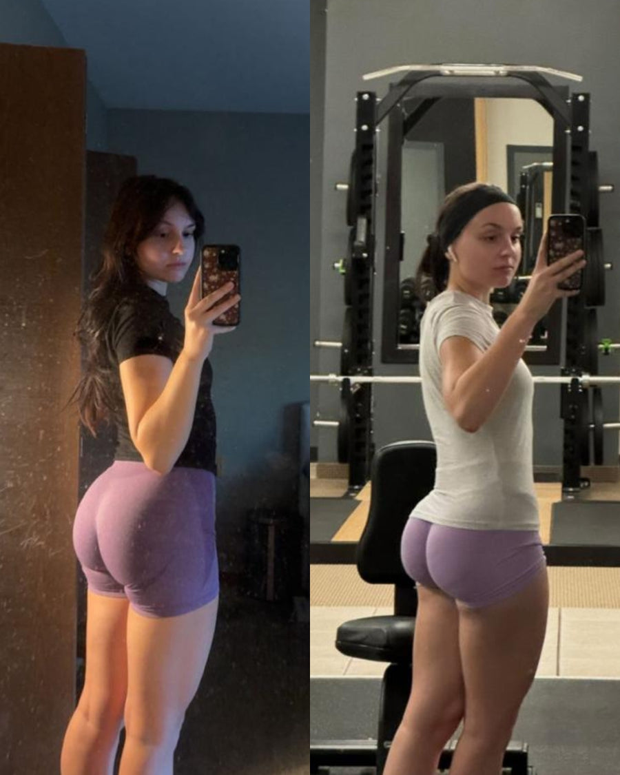 RareBody member before and after