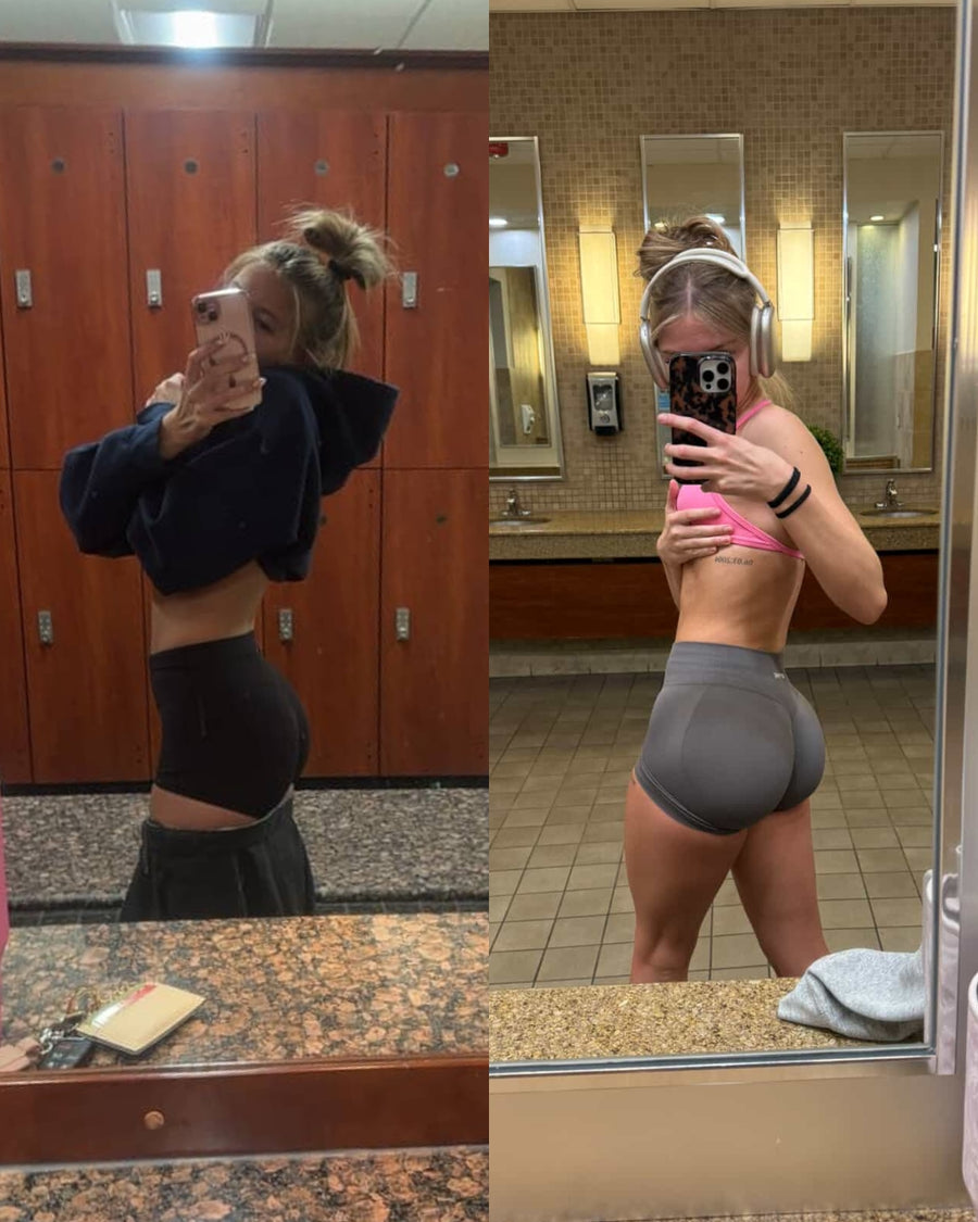 RareBody member before and after
